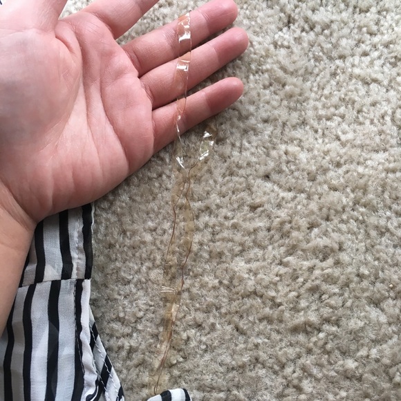 Foreign exchange striped button tank top - Picture 7 of 8